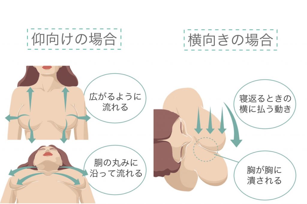 仰向けの場合と横向きの場合